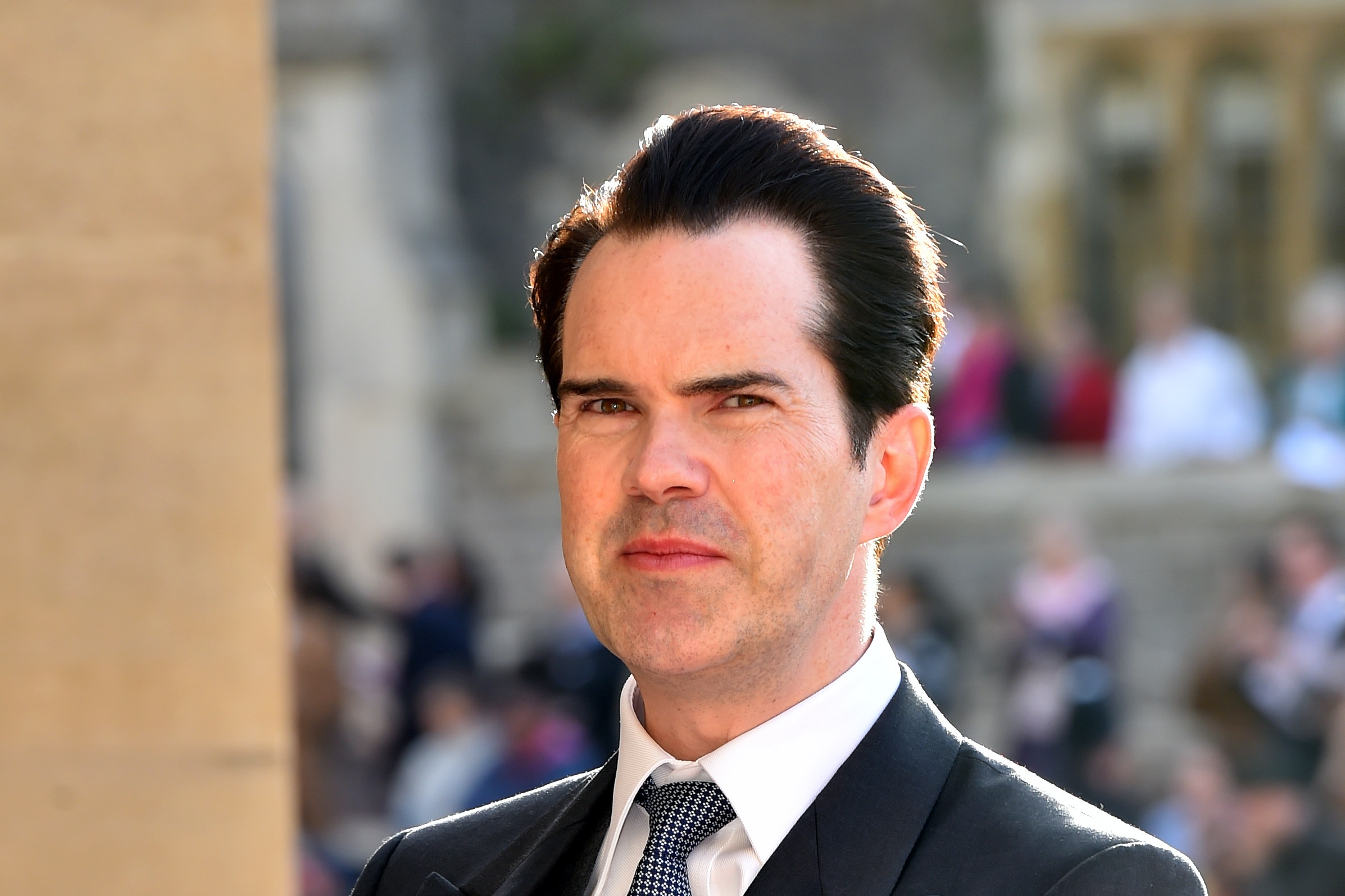 jimmy carr hair transplant